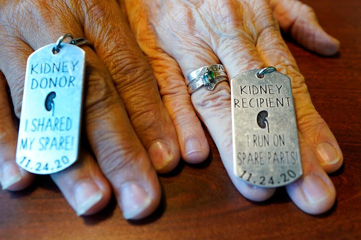 Debby-Neal Stricland and Mylaen Merthe show off donor/recipient tags they had made during a get together Tuesday, May 25, 2021, at a restaurant in Ocala, Fla. Debby now married to Jim Strickland donated a kidney to Mylaen Merthe, Jim's ex-wife. (AP Photo/John Raoux)