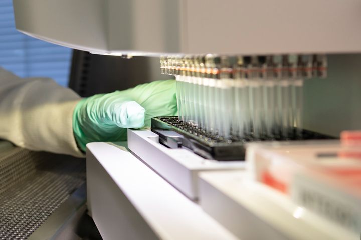In this 2019 photo provided by Biogen, a researcher works on the development of the medication aducanumab in Cambridge, Mass. 