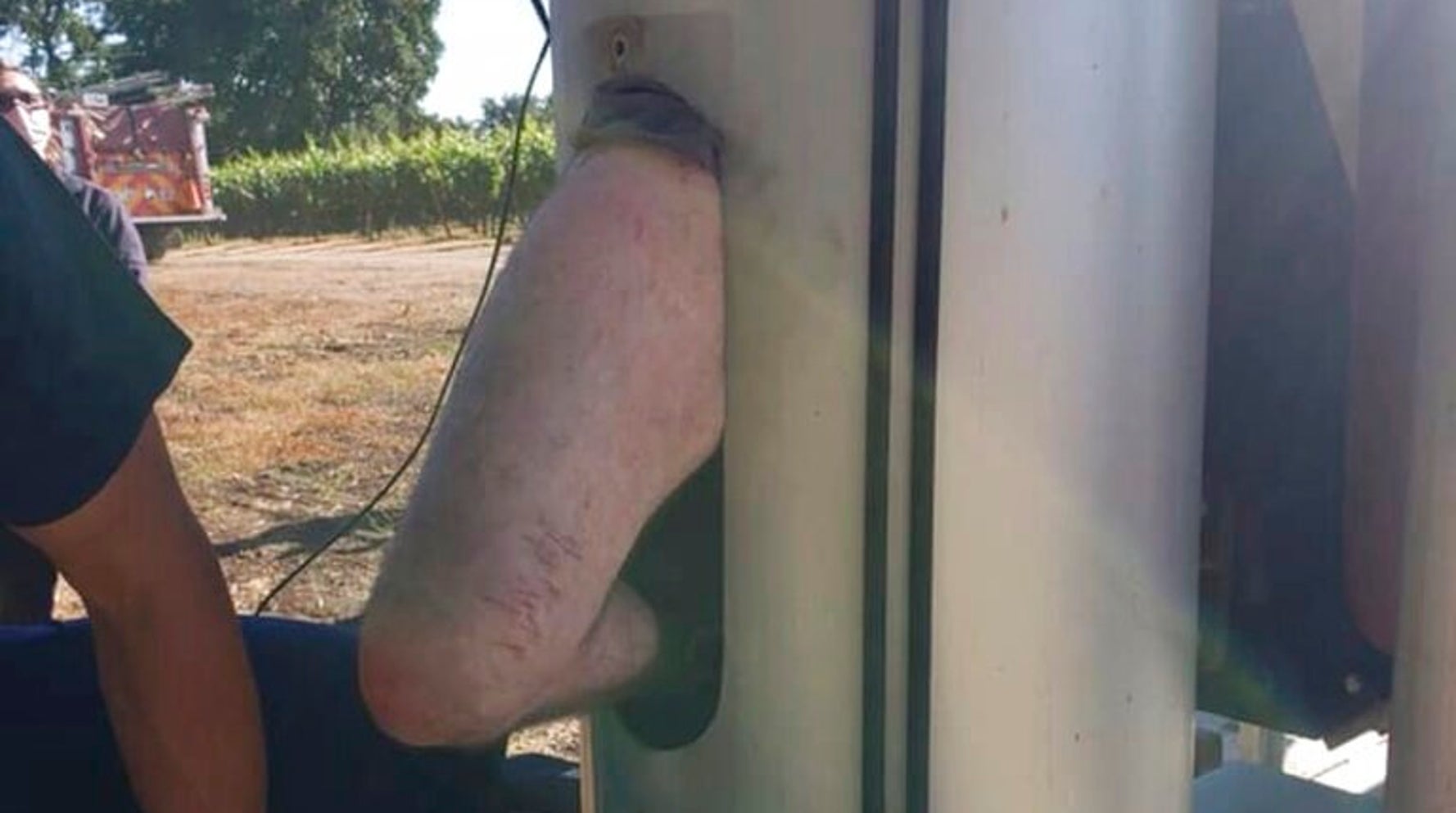 Man Rescued After 2 Days Stuck Inside Giant Fan At California Vineyard