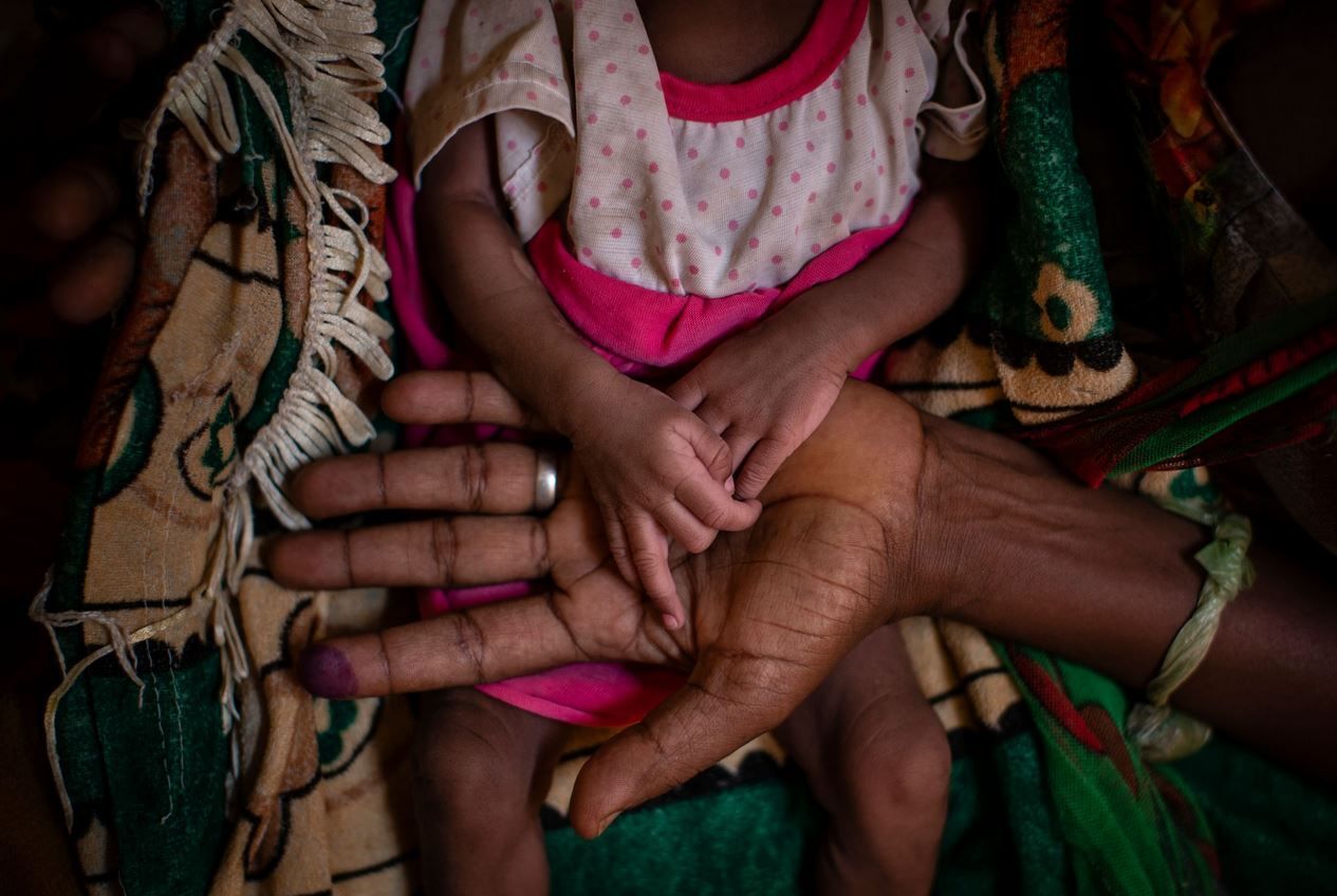 Η Αμπέμπα Γκεμπρού, 37 ετών, από το χωριό Γκετσκιμιλέσλι της Αιθιοπίας, κρατά στα χέρια της, την μόλις 20 ημερών υποσιτισμένη κόρης της, Τίγκστι Μαντερακάλι, στη σκηνή ιατρικής κλινικής στην πόλη Αμπί Αμπί, στην περιοχή Τιγκράι της βόρειας Αιθιοπίας.