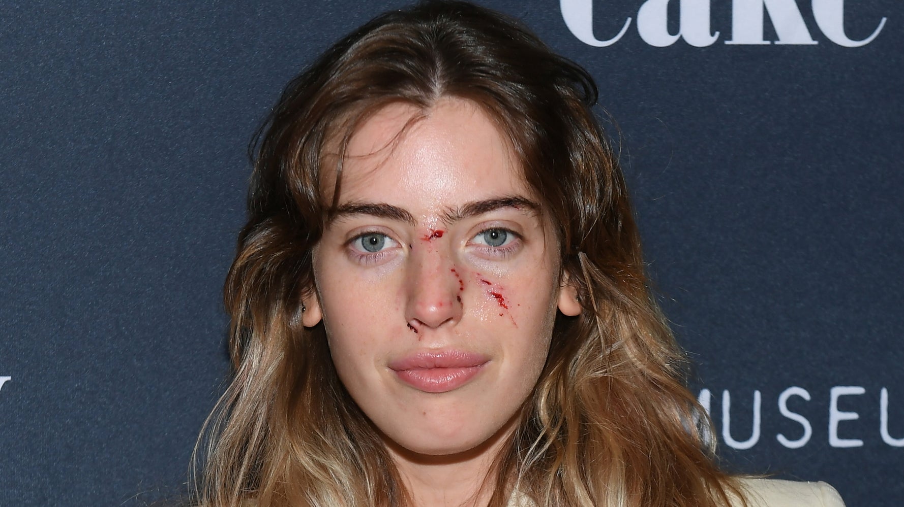 犬に噛まれたクララ マクレガー 傷顔でレッドカーペットに登場 めっちゃタフ と驚かれる ハフポスト World 犬に噛まれたクララ マクレガー 傷顔でレッドカーペットに登場 めっちゃタフ と驚かれる ハフポスト World