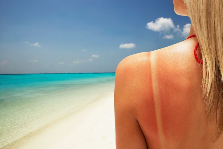 Don't let your next beach vacation threaten your life. Grab some sunscreen!