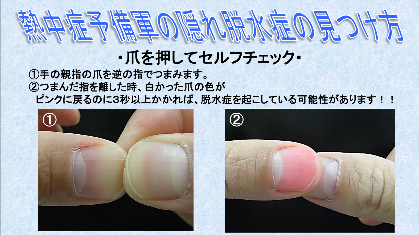 熱中症のセルフチェック 爪を押すだけで簡単にできる 厚労省発表の方法が便利 ハフポスト 熱中症のセルフチェック 爪を押すだけで簡単にできる 厚労省発表の方法が便利 ハフポスト