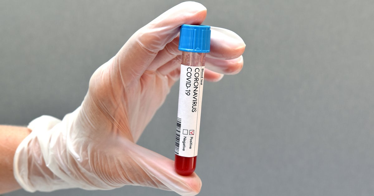The 'Game-Changing' Antibody Tests That Could Detect Covid Variants ...