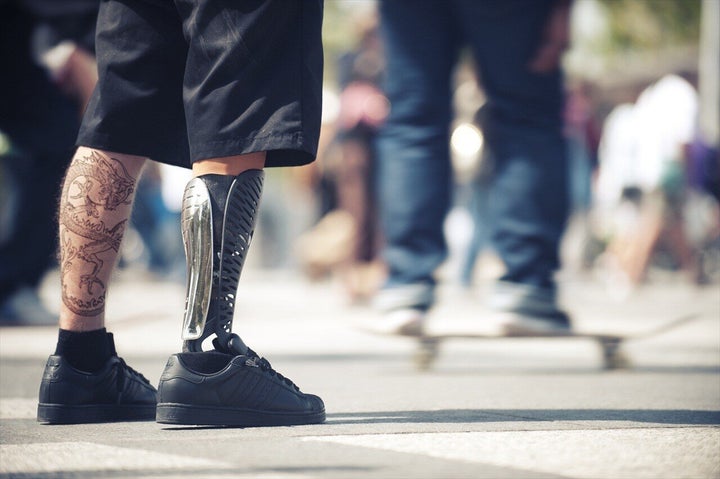 Stylish Prosthetic Limbs Boost Amputees' Quality of Life