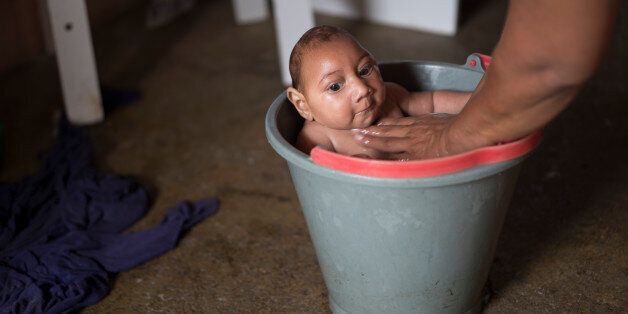 In this Dec. 23, 2015 photo, Solange Ferreira bathes her son Jose Wesley in a bucket at their house in Poco Fundo, Pernambuco state, Brazil. Ferreira says her son enjoys being in the water, she places him in the bucket several times a day to calm him. (AP Photo/Felipe Dana)