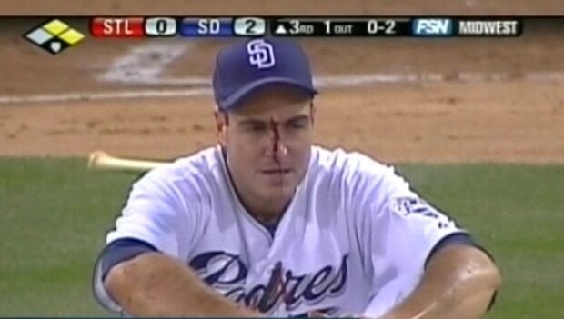 Line Drive Strikes Pitcher's Face