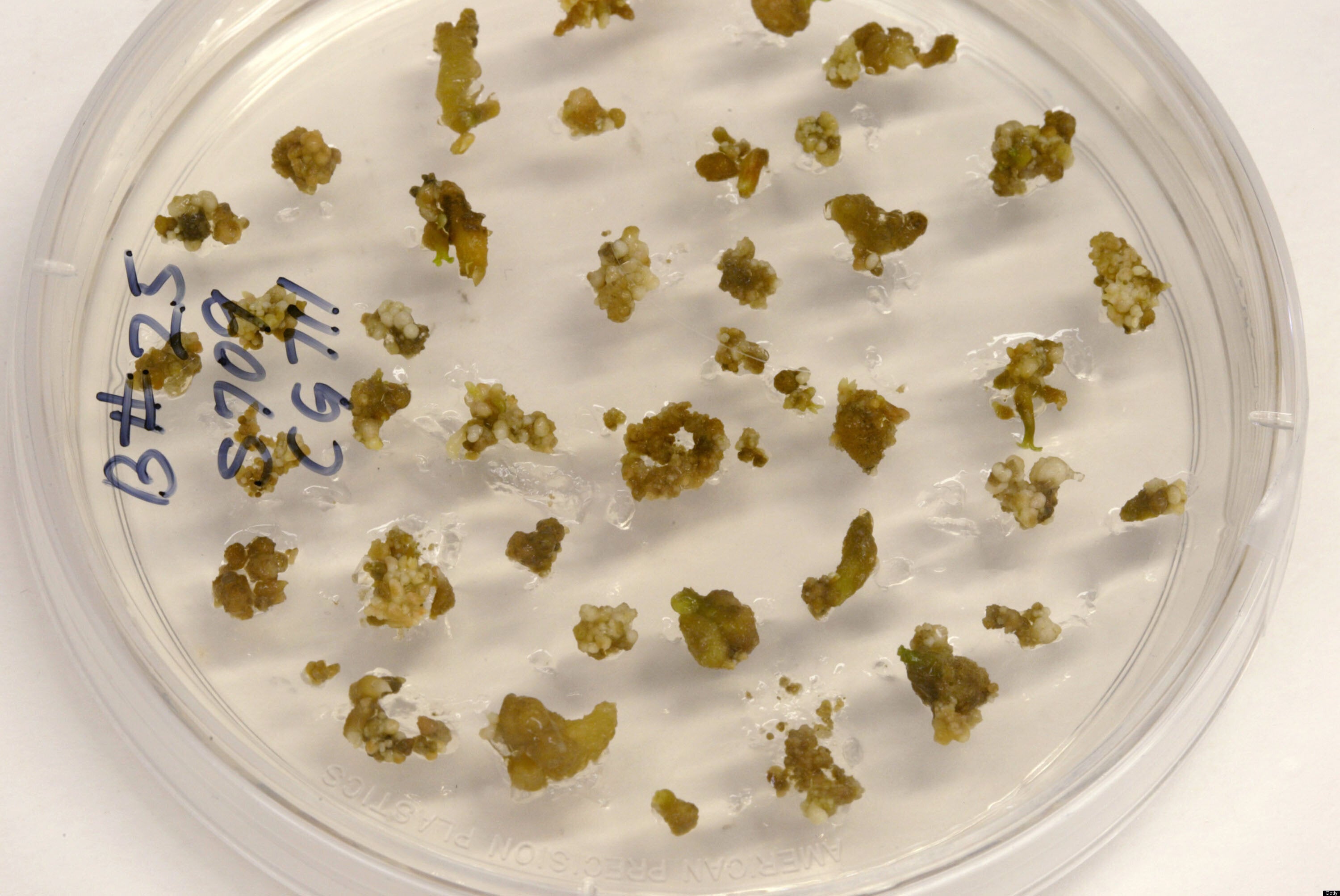pictures of parasites in human stool pictures of parasites in human stool