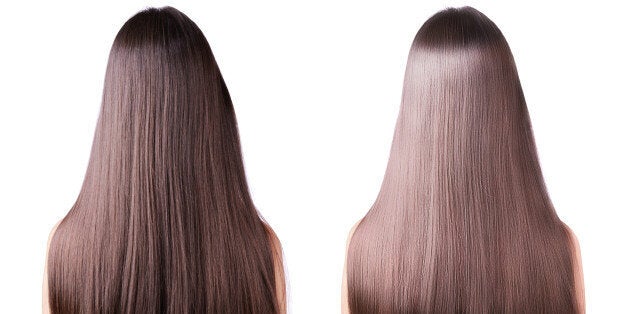 alisado láser fotónico desventajas