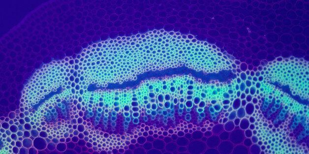 Light micrograph of a cross section of a vascular bundle from the stem of a Matricaria, a dicot. 30x @ 35 mm.