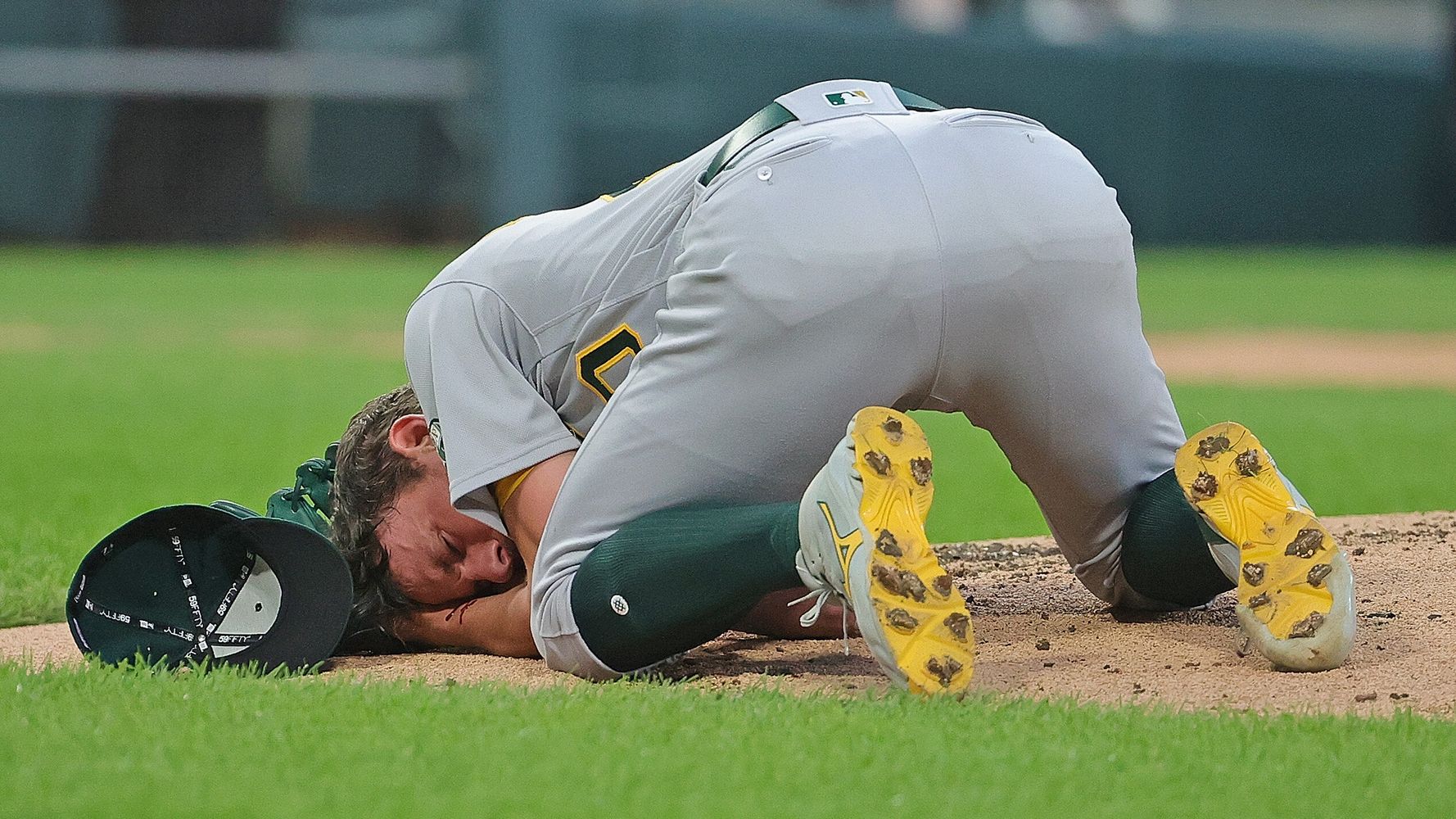 MLB Pitcher Taken To Hospital After Being Struck In The Head By A Line Drive