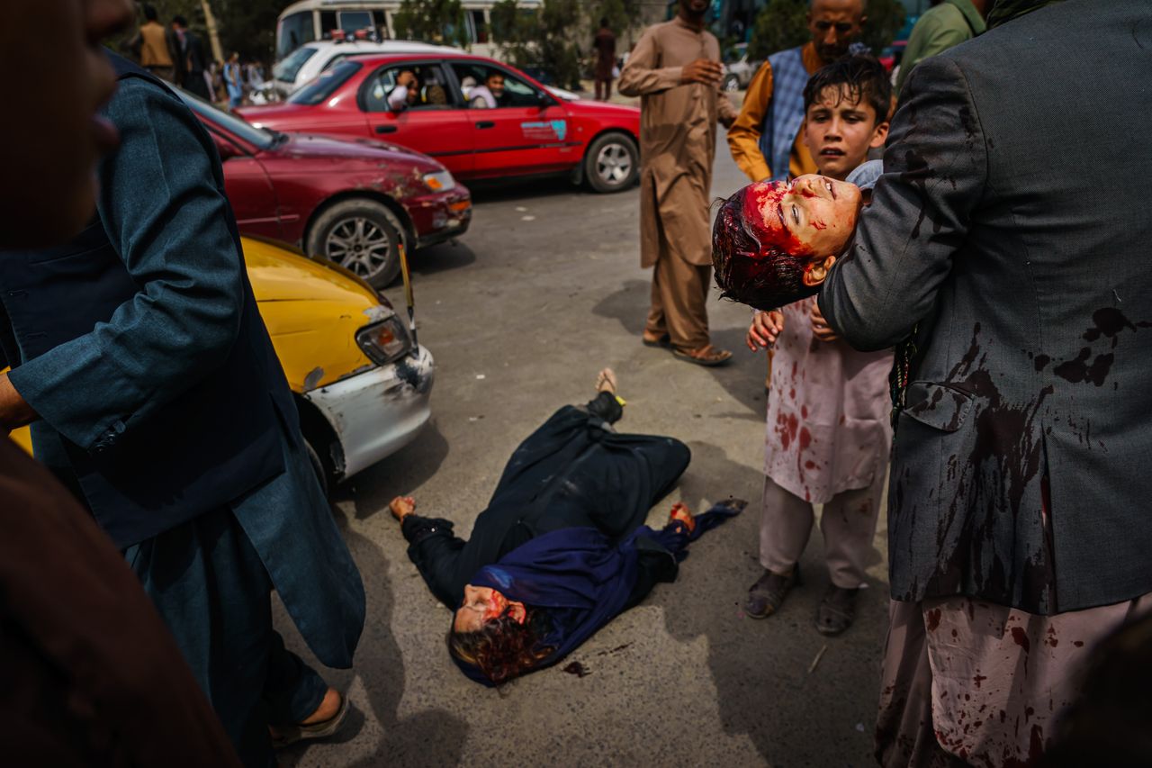 Ενας άνδρας κρατάει στην αγκαλιά του το ματωμένο του παιδί ενώ μια γυναίκα κείτεται αιμόφυρτη στο έδαφος, καθώς οι Ταλιμπάν προσπαθούν με πυρά, μαστίγια και στυλιάρια να ελέγξουν το πλήθος.