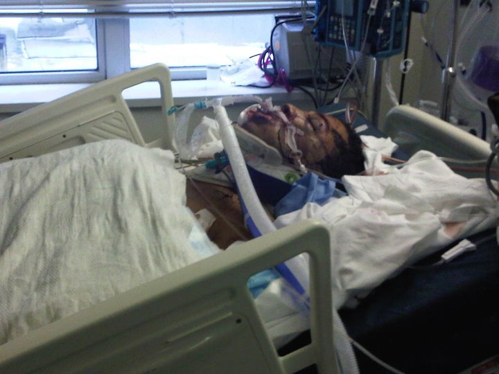 The author at the Elmhurst Trauma Hospital in New York City, approximately 12 hours after he was struck by a subway train in December 2010.