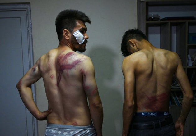 Afghan newspaper Etilaat Roz journalists Nematullah Naqdi (L) and Taqi Daryabi claim the Taliban beat...
