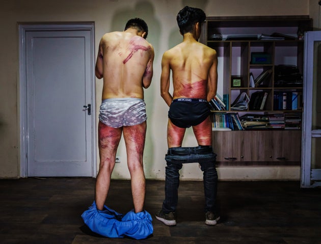 The journalists, Nematullah Naqdi (left) and Taqi Daryabi, said they were beaten with electrical cables,...