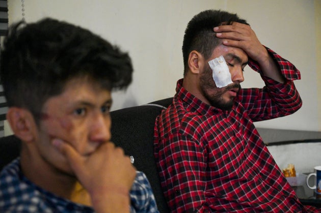 The two journalists were beaten for trying to cover the women's protest in