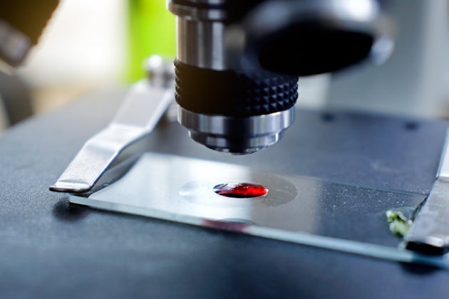 Scientist working with blood sample in laboratory