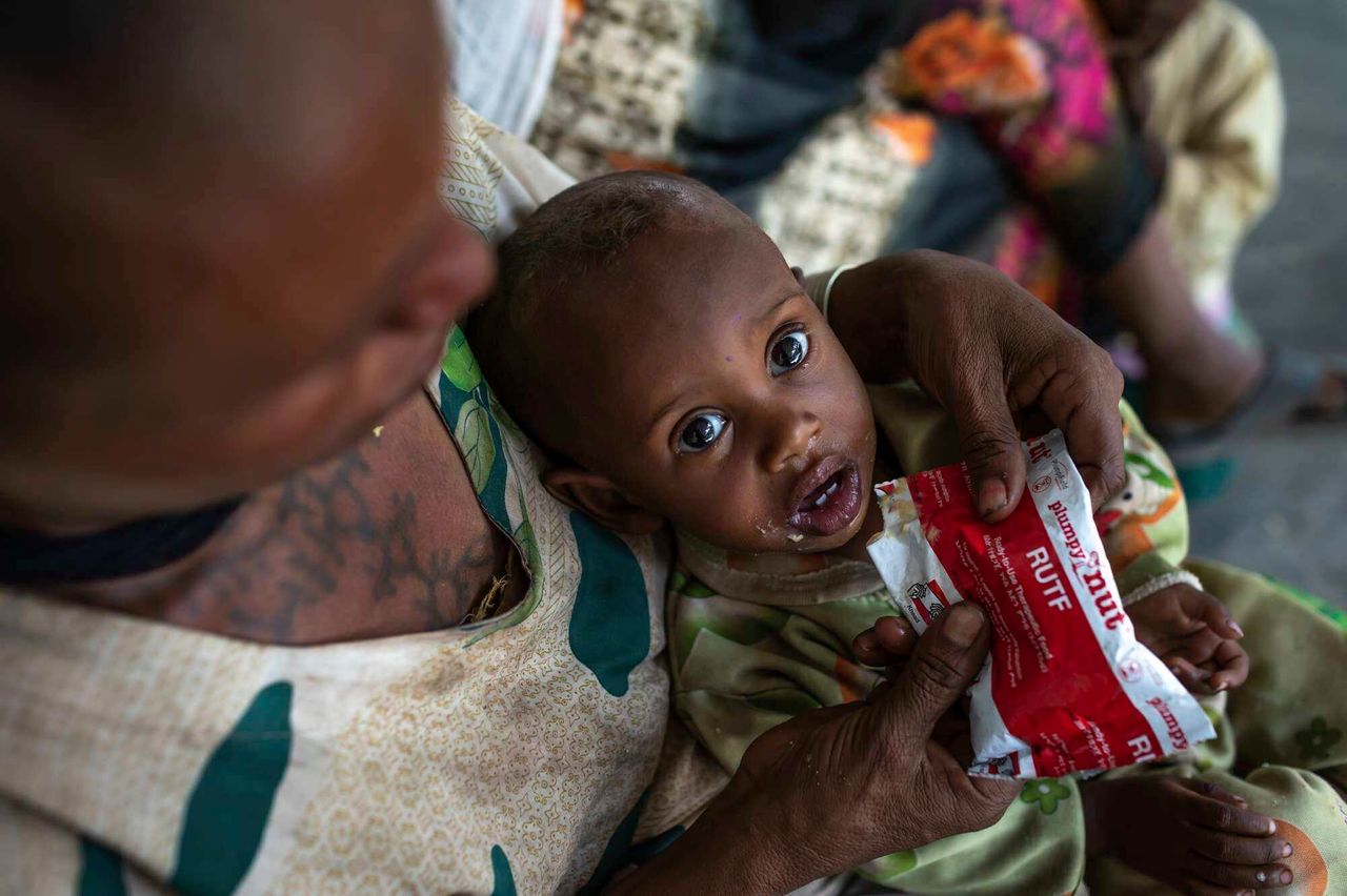 Η Λετμεντίν Εϊάσου κρατάει τον ενός έτους γιο της Ζεγουίλα Γκεμπρού, ο οποίος υποφέρει από υποσιτισμό, σε ένα κέντρο υγείας στο Άγκμπε της Αιθιοπίας τη Δευτέρα 7 Ιουνίου 2021. (Mulugeta Ayene/UNICEF via AP)
