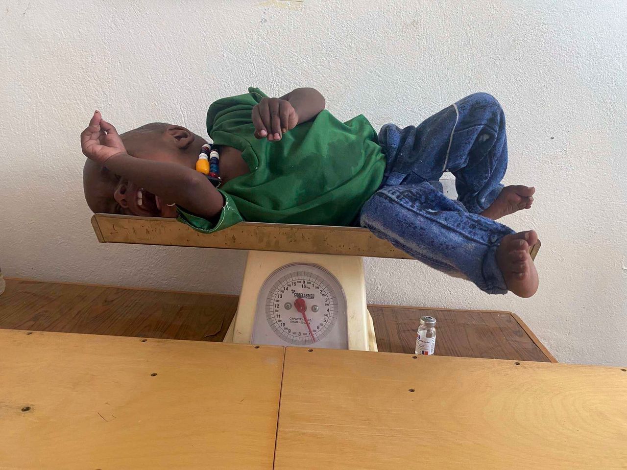 Ο Αμάνουελ Μπερχανού ζυγίζεται μετά την διάγνωση του σοβαρού υποσιτισμού του, στο Τιγκρέι, Δευτέρα 19 Ιουλίου 2021. (Zerihun Sewunet/UNICEF via AP)