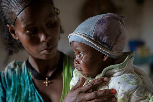 Mother Ababa, 25, comforts her baby Wegahta, 6 months, who was identified as severely acutely malnourished, in Gijet in the Tigray region of northern Ethiopia Tuesday, July 20, 2021. For months, the United Nations has warned of famine in Tigray and now internal documents and witness accounts reveal the first starvation deaths since Ethiopia's government in June imposed what the U.N. calls 