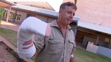 La mano del hombre australiano está 'un poco adolorida' después del ataque de un cocodrilo saltarín