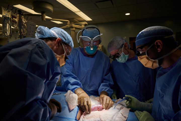 In this September 2021 photo provided by NYU Langone Health, a surgical team examines a pig kidney attached to the body of a deceased recipient for any signs of rejection. (Joe Carrotta/NYU Langone Health via AP)