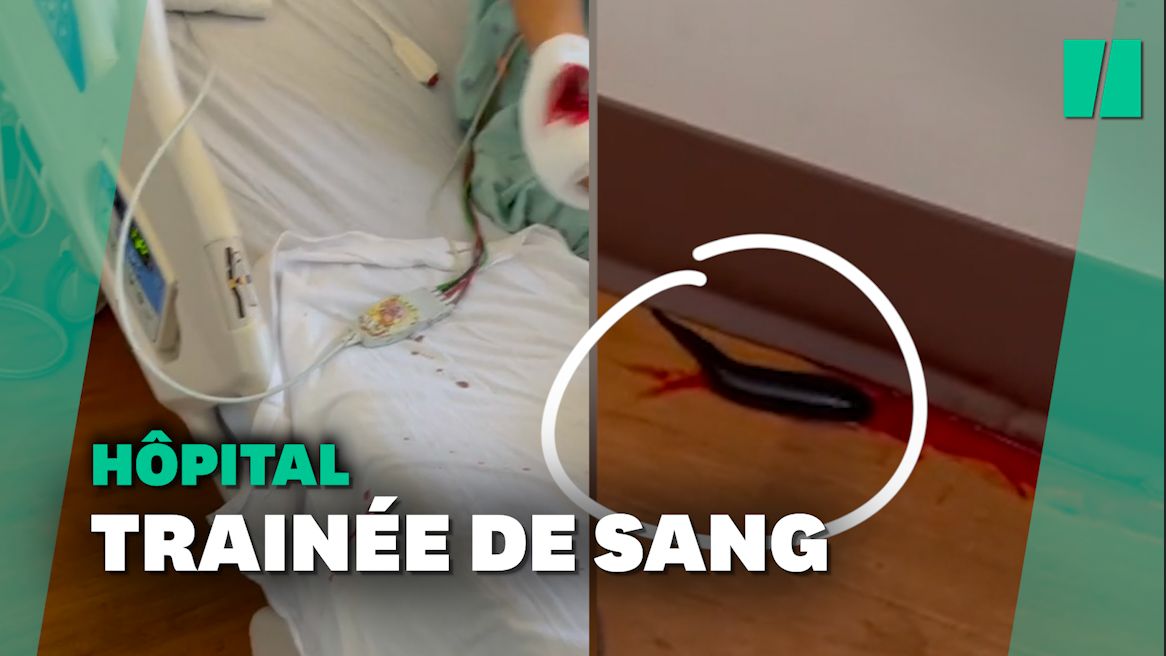 Cette sangsue a transformé une chambre d'hôpital en film d'horreur