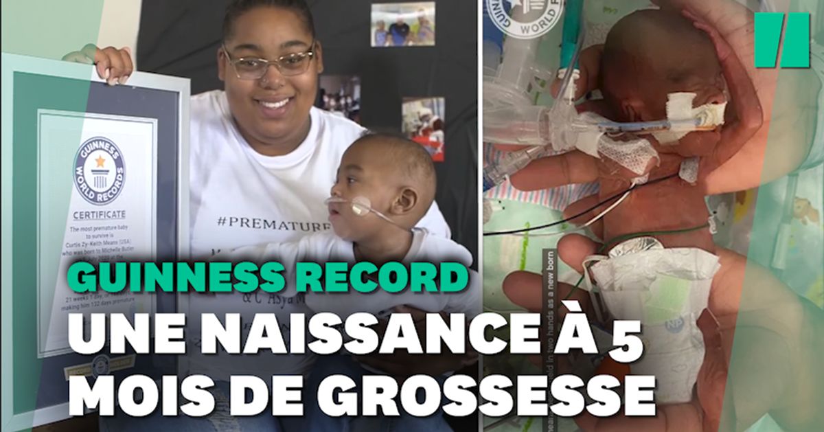 Ne Apres 5 Mois De Grossesse Ce Bebe Est Le Plus Grand Premature Au Monde Flipboard