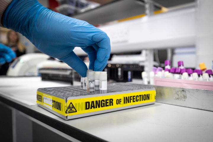 Clinical support technician Douglas Condie extracts viruses from swab samples so that the genetic structure of a virus can be analysed and identified in the coronavirus testing laboratory at Glasgow Royal Infirmary, on February 19, 2020 in Glasgow, Scotland. 