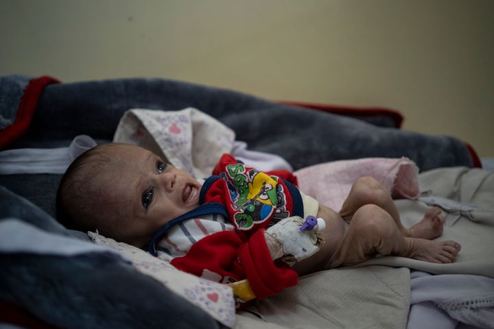O Μοχάμεντ είναι 4 μηνών, υποσιτισμένος και για μέρες νοσηλεύεται, αν και χωρίς πολλές παροχές, σε νοσοκομείο στην Καμπούλ (8 Νοεμβρίου 2021)