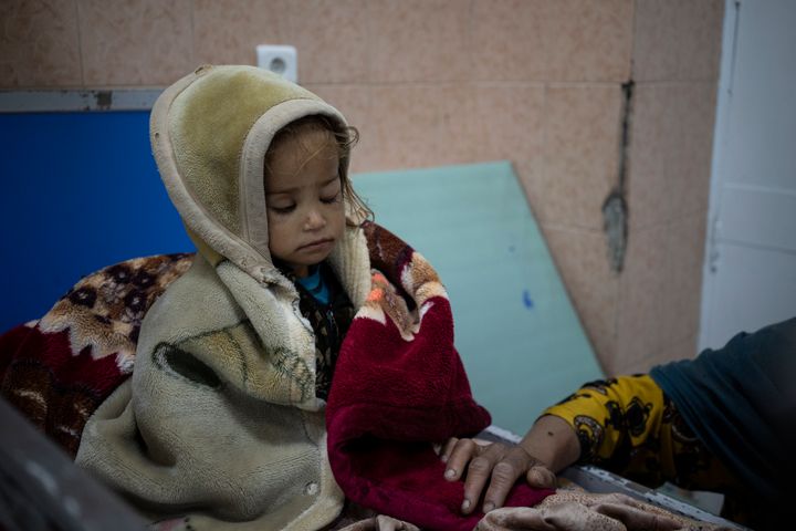 Γκουντάνα, 2 ετών σε νοσοκομείο στην Καμπούλ. Σοβαρά υποσιτισμένη, αδυνατεί να κρατήσει ανοιχτά τα μάτια της (8 Νοεμβρίου 2021)