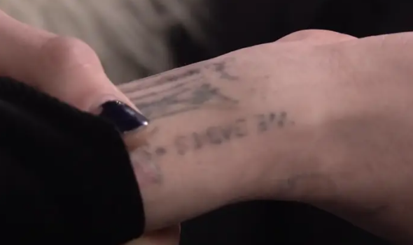 What remains of Davidson’s tattoo.