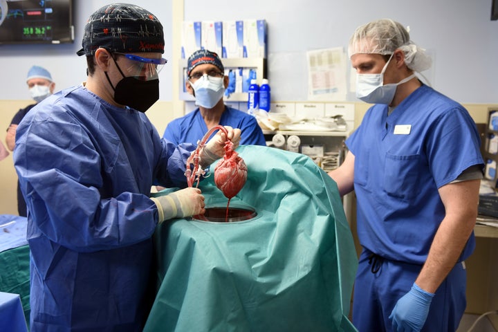 American Surgeons Transplant A Pig'S Heart Into A Human Patient 1 In This Photograph, Provided By The University Of Maryland School Of Medicine, Members Of The Surgical Team Show A Pig'S Heart For Transplant To Patient David Bennett In Baltimore On Friday, January 7, 2022. On Monday, January 10, 2022, The Hospital Reported That He Was Doing Well Three Days After The Experimental Surgery. (Mark Teske / University Of Maryland School Of Medicine Via Ap)