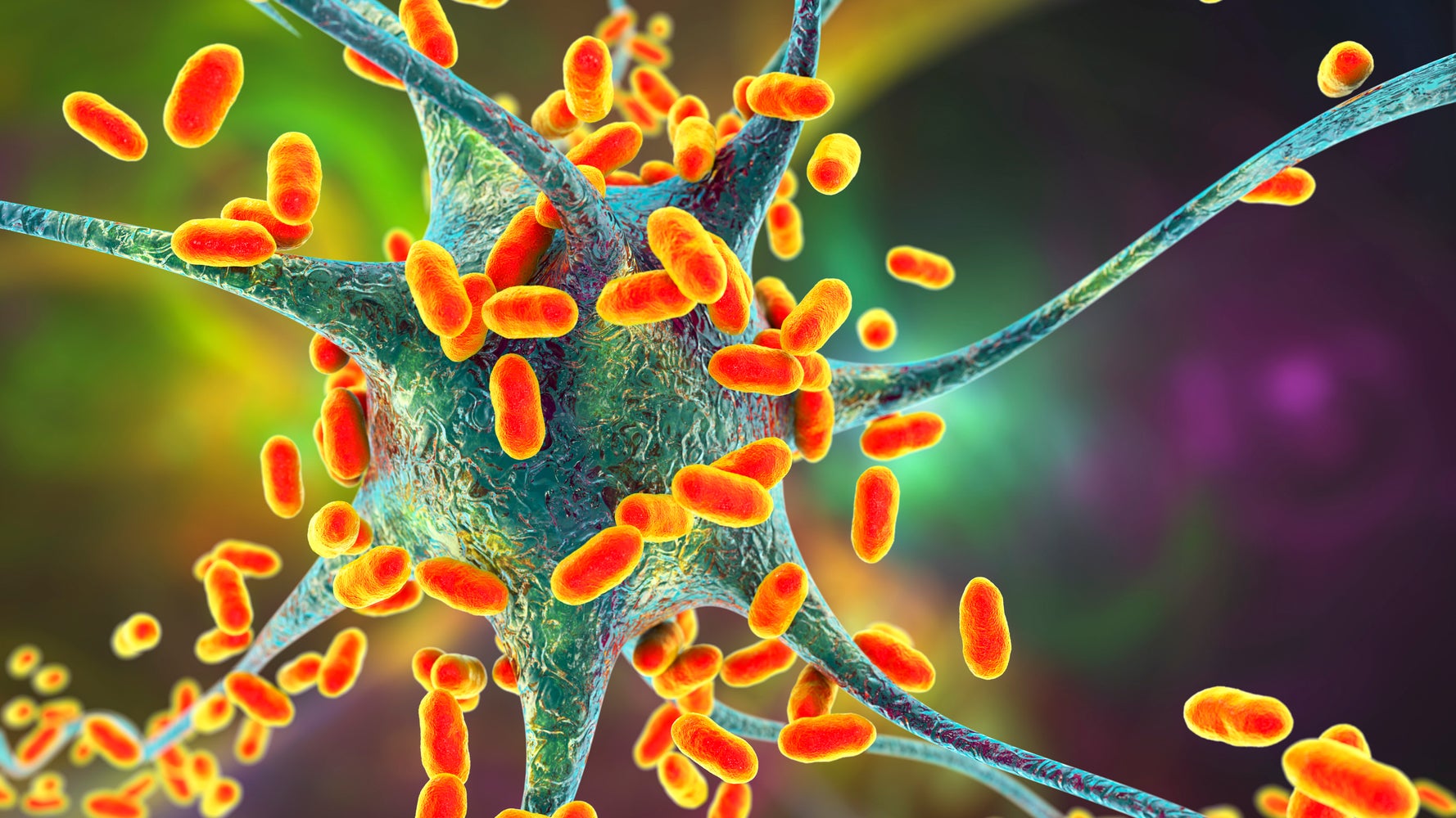 Dole Prepackaged Salads Recalled Due To Potential Listeria