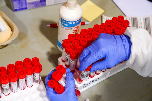 Σύλλογος εργαζομένων εξασφάλισε PCR τεστ με 25
