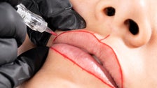 TikTok’s Latest Lip-Plumping Technique Could Signal The End Of Lip Injections