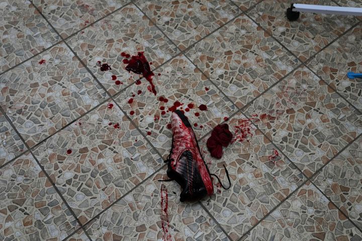 A shoe covered in blood lies on the floor March 2 at an emergency surgery in a maternity hospital converted into a medical ward.