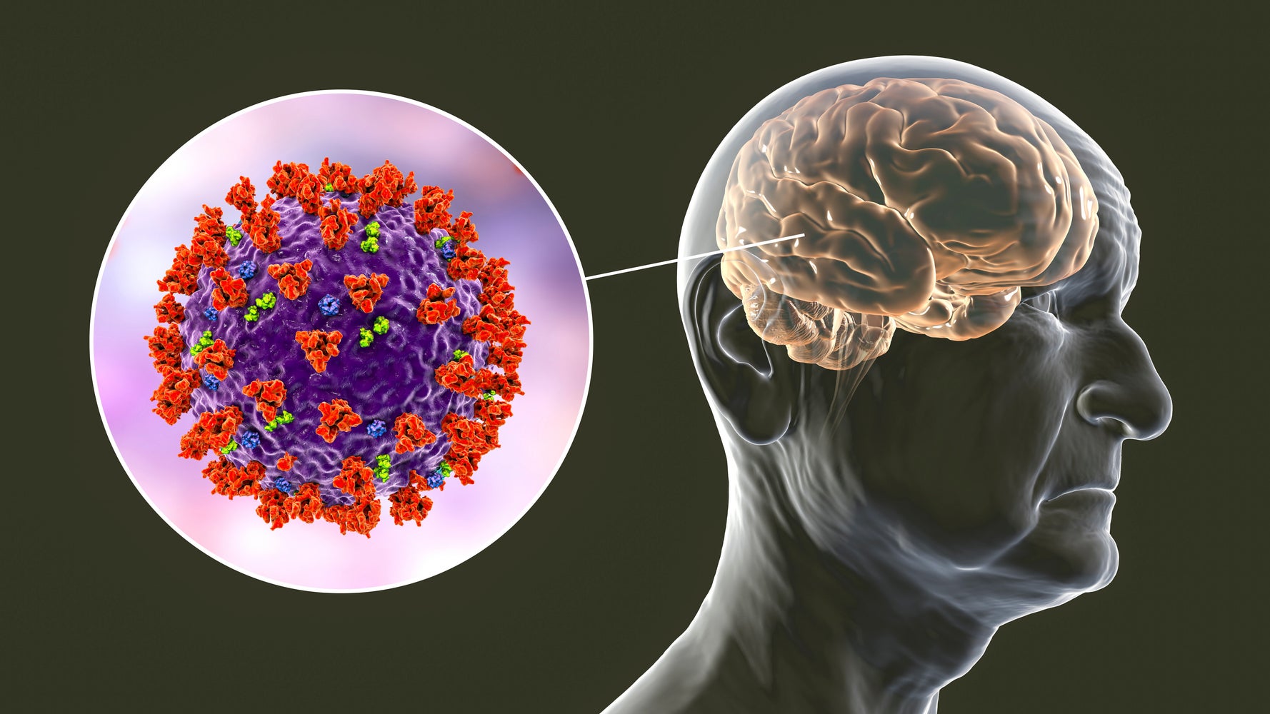 It's Official: Covid Is Messing With Our Brains