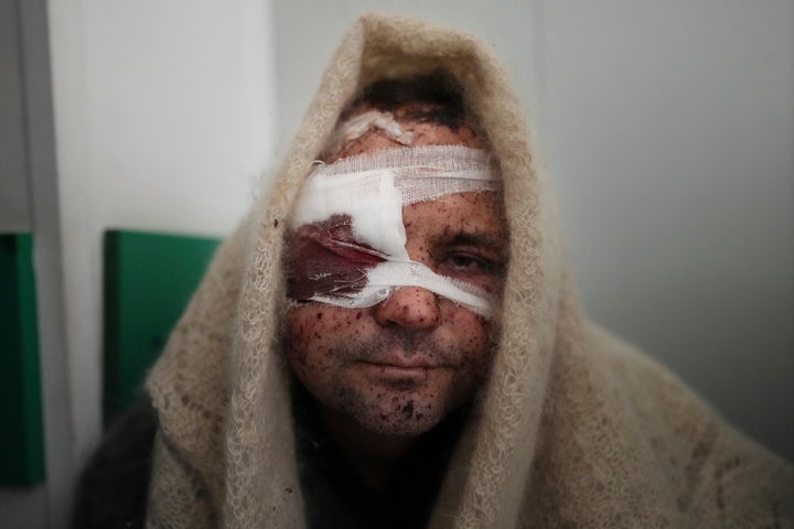 Serhiy Kralya, 41, looks at the camera after surgery at a hospital in Mariupol, eastern Ukraine on Friday, March 11, 2022. Kralya was injured during shelling by Russian forces. (AP Photo/Evgeniy Maloletka)