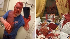 Nobel Prize-Winning Russian Newspaper Editor Attacked With Paint In Moscow Nobel Prize-Winning Russian Newspaper Editor Attacked With Paint In Moscow