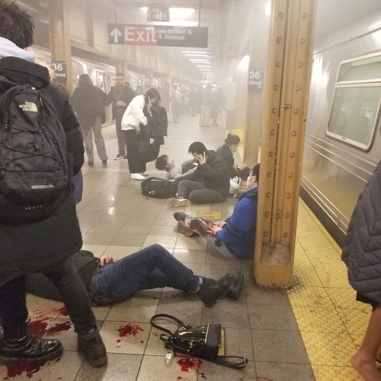 Wounded people at the 36th Street subway station after the shooting.