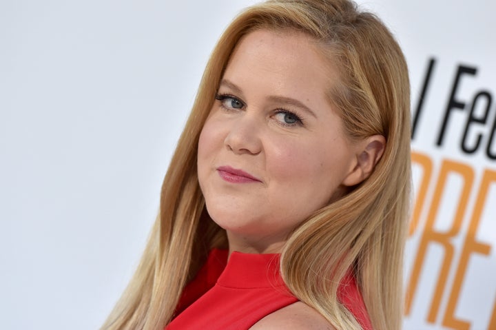 Amy Schumer said she wore a wig to school when she was a teenager because she had pulled out so much of her hair.