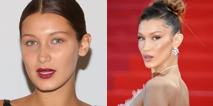 Bella Hadid before and after her rhinoplasty.