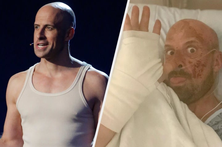 Jonathan Goodwin on stage in America's Got Talent and (right) in the hospital after his fall.
