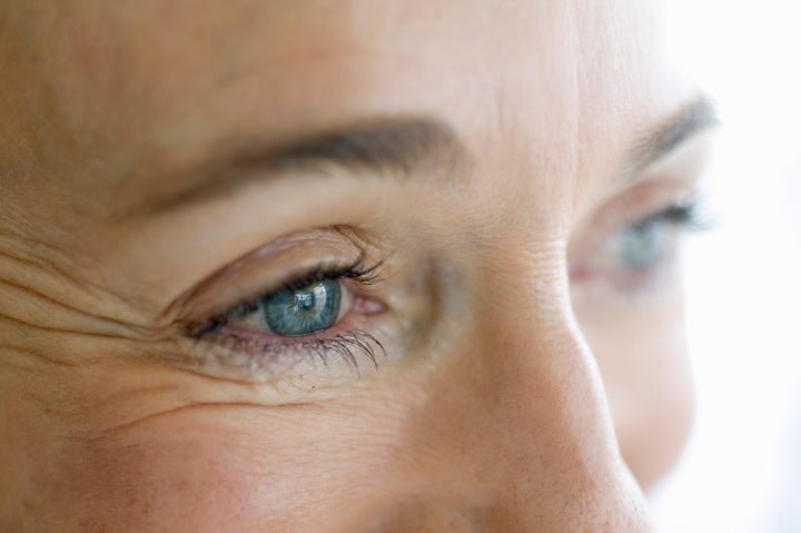 Can deep wrinkles be treated as easily as fine lines?