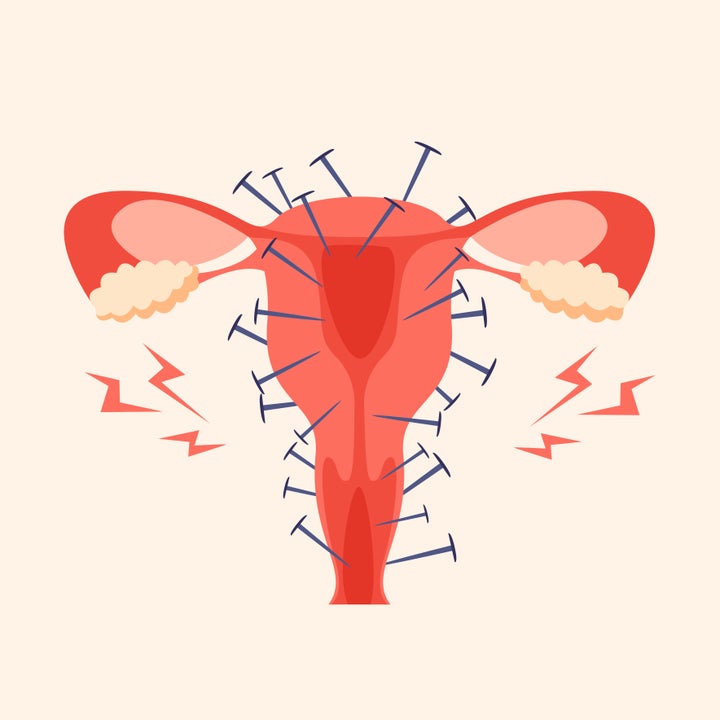 Dolor menstrual.