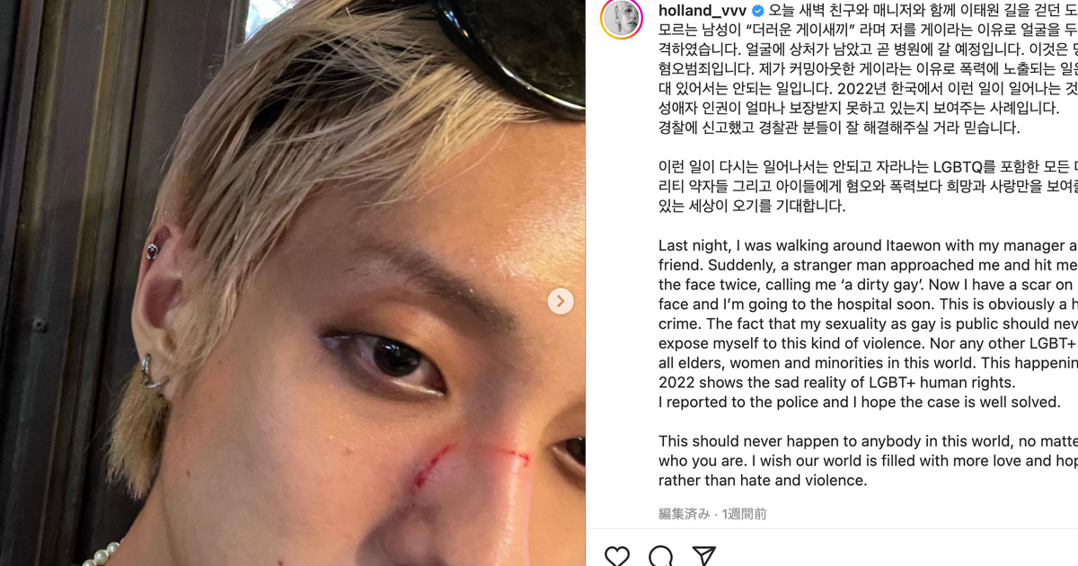 ゲイ公表のk Pop歌手 暴行被害を明かす ネットの同性愛嫌悪コメントには 心が崩壊しそうになった ハフポスト アートとカルチャー ゲイ公表のk Pop歌手 暴行被害を明かす ネットの同性愛嫌悪コメントには 心が崩壊しそうになった ハフポスト アートとカルチャー