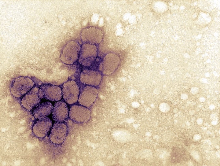 Imagen del virus de la viruela.