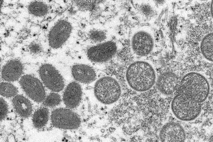 This 2003 electron microscope image made available by the Centers for Disease Control and Prevention shows mature, oval-shaped monkeypox virions, left, and spherical immature virions, right, obtained from a sample of human skin associated with the 2003 prairie dog outbreak. 