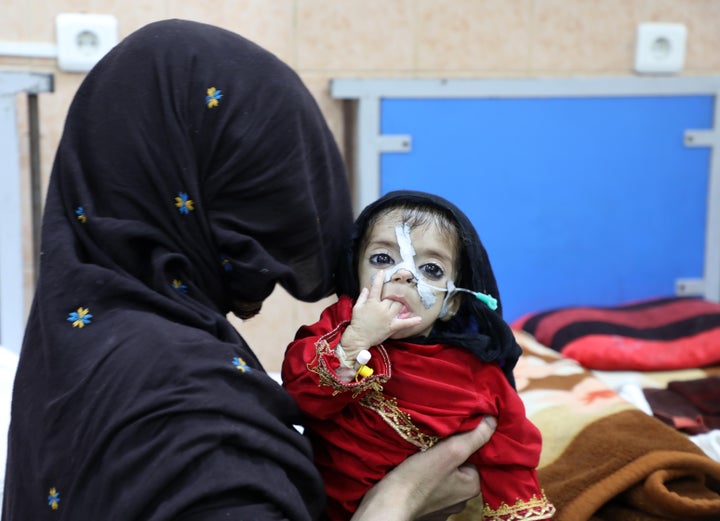 Un bebé afgano con malnutrición severa, retratado en un hospital de Kabul el pasado enero.
